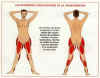 liposuccion.jpg (32632 octets)